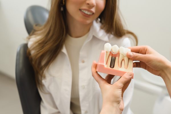 dental implant model